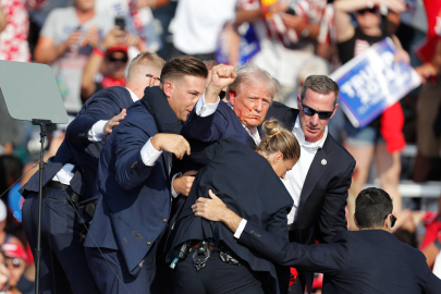 Doktoru Trump'ın kulağına mermi değil şarapnel isabet ettiği iddiasını yalanladı